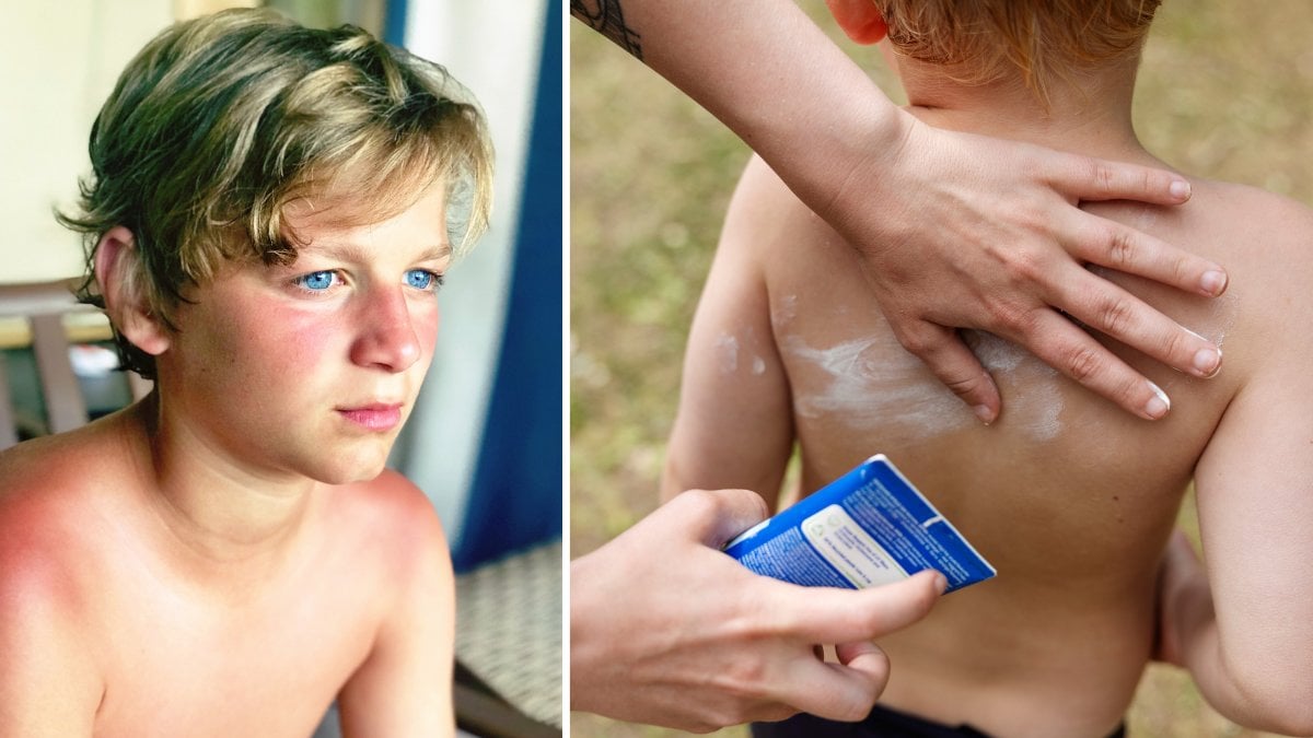 Skydda ditt barn från solen